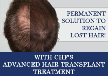 Hair Transplant in Chennai